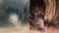 Hair Elixir